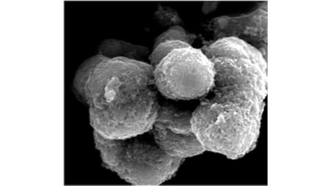 Microscope image of rounded, textured cathode particles against a black background.