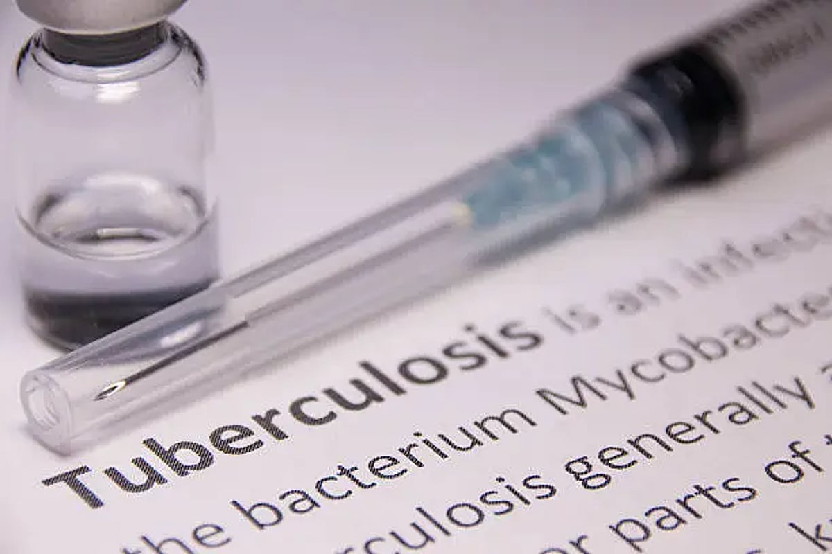 Researchers Develop Portable Device That Detects Tuberculosis Using Smartphones
