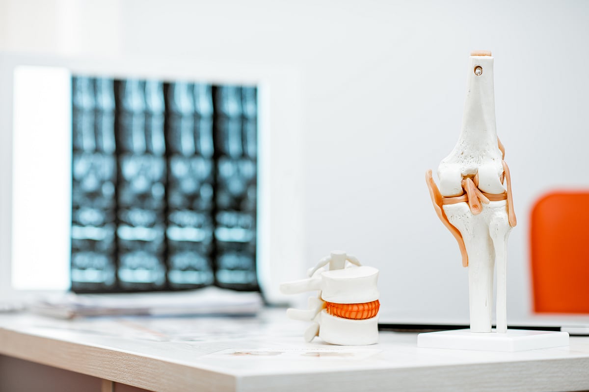 <div class="paragraphs"><p>Prolia is a prescription medicine used to treat osteoporosis in women who have been through menopause and in men who are at increased risk of fractures.(Photo: Envato)</p></div>