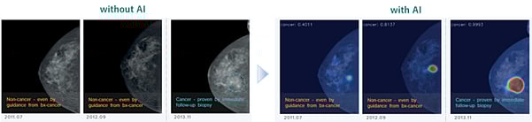<div class="paragraphs"><p>How AI enhances accuracy and detects irregularities that might be missed by the human eye. (Image: Nura)</p></div>