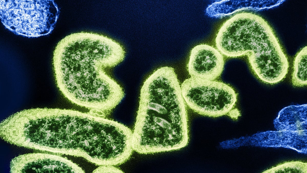 <div class="paragraphs"><p>Representative Image. (Image Source: Unsplash)</p></div>