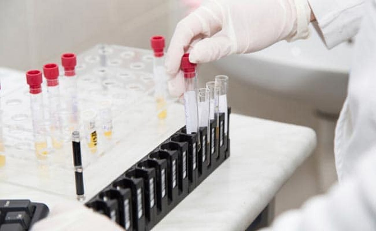 Divi's Labs Shares In Focus As Jefferies Upgrades To 'Buy', Eyes 16% Upside On Sustained Growth Momentum