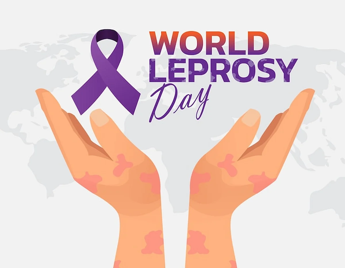 World Leprosy Day 2024 Date, Theme, History, Significance And More