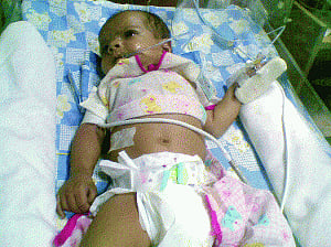 Noida infant turns blue after being fed  borewell water