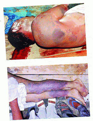 Gzb custody death victim's post-mortem  report reveals 12 ante-mortem injuries