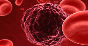 New chip to capture live tumour cells in blood