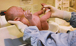 Caesareans weaken gut microbiota and raise risk of allergies