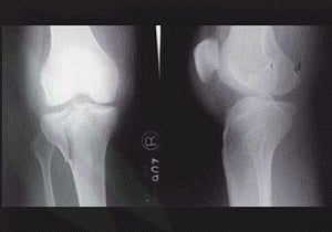 Free X-rays at government hospitals in Uttar Pradesh