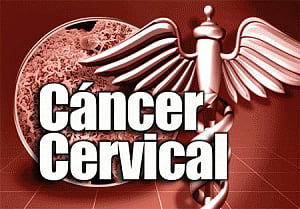 Timely tests can cut cervical cancer by a third: Expert
