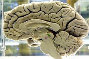 Early diagnosis can check dementia