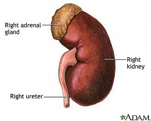 Acute kidney injury may up risk of heart problems later