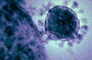 MERS cases rise to 480 in Saudi Arabia
