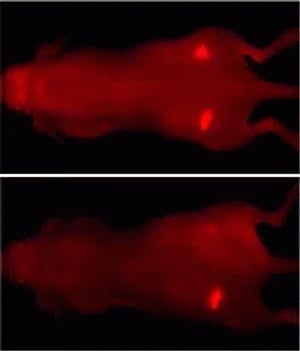New technology may improve light-based cancer treatment