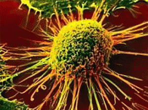Cancer has potential on-off switch: study