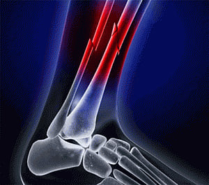 Better tissue healing with 'dissolving' hydrogels