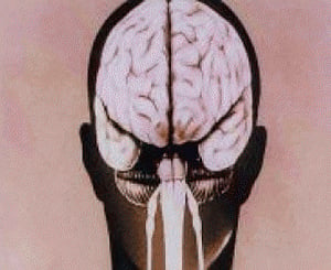 Gene critical for brain development identified