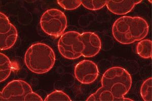 Coming soon: Vaccine to prevent brain cancer
