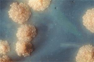 WHO targets elimination of TB in over 30 countries