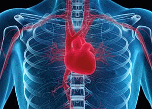 Cheaper drug for heart attack procedure improves outcomes