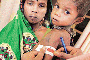 Childhood TB higher than WHO estimates: Study