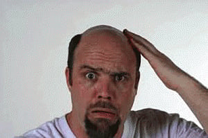 Bald men in 40s at higher risk of prostate cancer