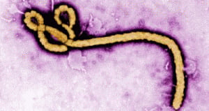 Thai scientists discover antibody to cure Ebola