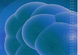 'Stem cell regime has no advantage over conventional treatment of stroke'