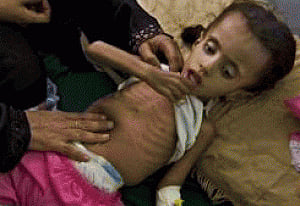 India leads in pre-term birth complication deaths: lancet