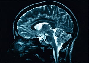 'Off switch' for pain discovered in the brain