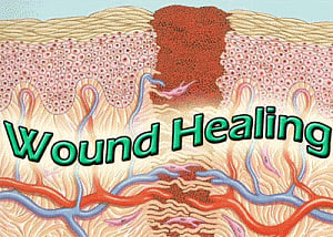 Key protein to speed up wound healing