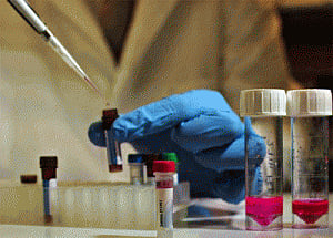 Novel DNA test could identify risk of frailty