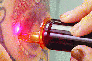 The dye won't be cast