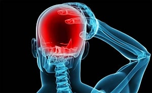New biomarker for migraine found