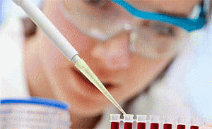 Blood test soon to detect Alzheimer's