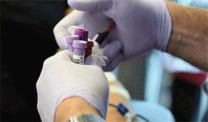 New test to measure if a person is pre-diabetic