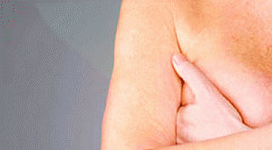 Doctors participate in breast cancer awareness drive