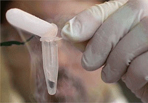 Inexpensive one-step test for hepatitis C infection