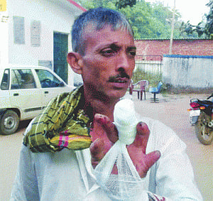 Ali Baba cuts one more finger as Nitish wins
