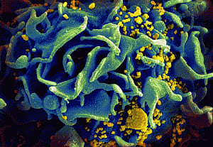 Japanese scientists discover HIV inhibiting protein