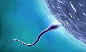 'Poor semen quality causing infertility in industrialised countries'