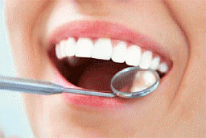 Bioactive glass fillings to prolong tooth life