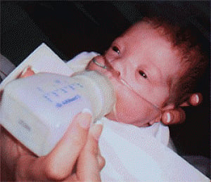 Blocking molecule may help prevent premature birth