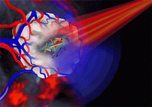 Gold nanotubes can destroy cancer cells