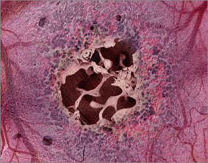 Bone marrow on a chip to study impact of radiation on humans
