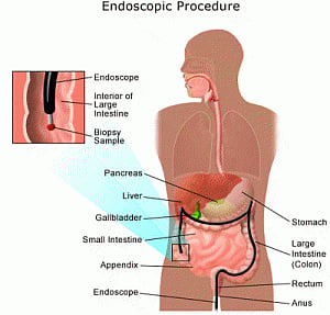 Intestinal gas can help diagnose diseases