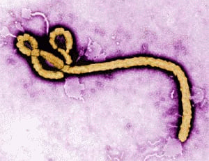 New study points to potential Ebola drug target