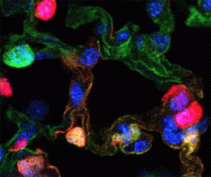 lung cells can regenerate from one another: study