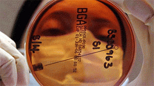 Men with high estrogen levels at breast cancer risk