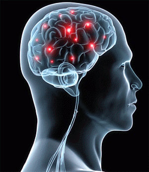Stroke steals eight years of brain function