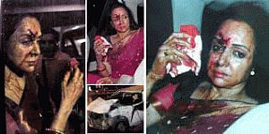 Hema Malini 'fine', driver held for child's death
